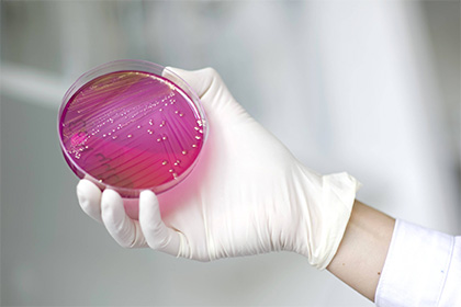 В моче индуса обнаружили неуязвимую бактерию