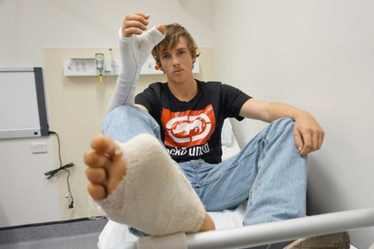 Австралийцу пересадили большой палец ноги на руку